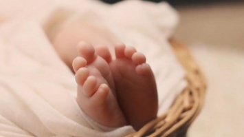 Впервые на свет родился ребенок с перевернутыми ногами и без ягодиц (фото)