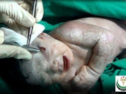 В Сирии родилась девочка со шрапнелью в голове