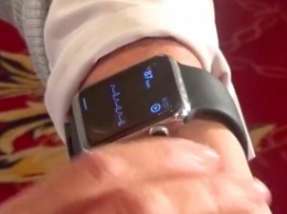 Создан ремешок для Apple Watch, который позволяет снимать ЭКГ