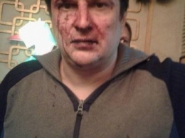 В Днепропетровске милиционер с "дружками" избили двух мужчин: рассказ потерпевшего