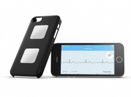 AliveCor Mobile ECG: как снять ЭКГ с помощью iPhone