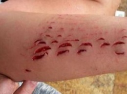 Испания: На острове Гран-Канария зафиксировано нападение акулы на человека