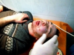 В Каховке жестоко избили депутата БПП в подъезде его же дома