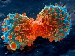 Заботу о раковых клетках назвали лучшим средством лечения опухолей