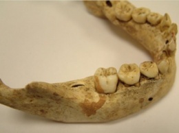 Британские ученые исследовали зубы детей Средневековья