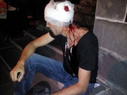 Под Киевом избили активиста Евромайдана, бежавшего из Севастополя