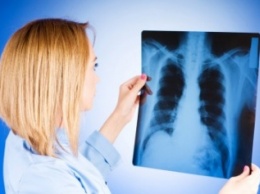 Днепропетровск входит в тройку лидеров по заболеваемости туберкулезом в Украине