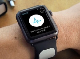 AliveCor представила ремешок для Apple Watch, позволяющий снимать ЭКГ [видео]