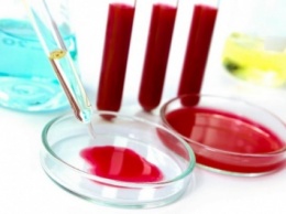 Ученые из Новосибирска разработали метод выявления рака по анализу крови