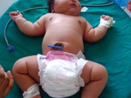 В Индии родилась девочка, вес которой составил 6,8 кг