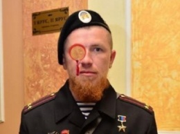 Плотницкий-Захарченко: А давай "Мотороле" выколем раненый глаз? - соцсети в анекдотах высмеяли ранения боевика