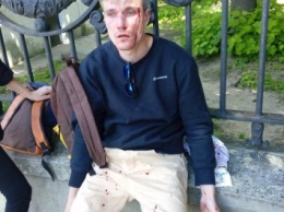 В Киеве неизвестные выследили гея после марша и избили до крови (фото)
