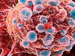 Ученые объяснили, почему рак возвращается после химиотерапии