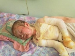 Мать с дочерью, пострадавшие во время взрыва в Мариуполе, находятся в крайне тяжелом состоянии (ФОТО)