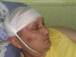 В Конотопе сильно избили депутата от "Свободы"