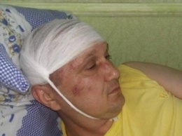 Депутата на Сумщине избили железными прутьями по голове (ФОТО)