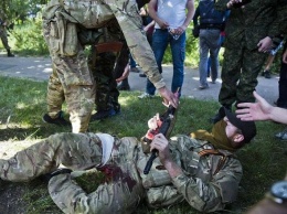 Состояние раненого в Луганской области бойца тяжелое, - Ткачук