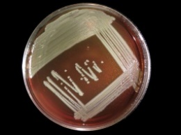 Бактерия, считавшаяся безвредной, вызвала смертельную инфекцию