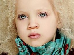 Афроамериканская девочка-альбинос покорила мир моды