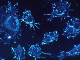Ученые нашли нестандартные варианты лечения рака