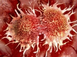 Ученые смогли проследить за «рождением» раковой клетки