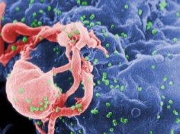 Иммунологи «написали» портрет устойчивого к ВИЧ человека
