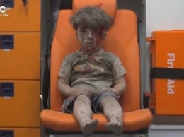 В Сирии брат названного "символом войны" мальчика скончался от полученных ранений