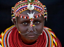 Житель Кении не может завести детей из-за огромного полового органа