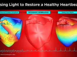 «Оптческий» кардиостимулятор успешно прошел первые тесты
