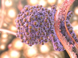 Ученые: Лекарство от гриппа может остановить образование метастаз при раковых заболеваниях