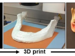 Ученые распечатали эластичные кости для «растущих» имплантатов