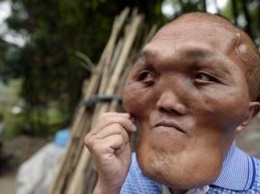 Загадка природы: китайский гражданин обладает внешностью инопланетянина