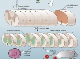 Стволовые клетки оказались средством от нейропатической боли