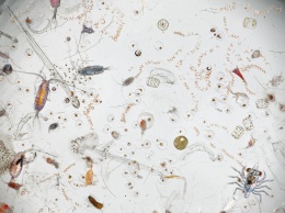 В Амстердаме покажут жизнь микробов под 3D-микроскопом