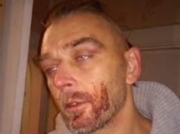 Патрульную полицию Николаева обвиняют в избиении десантника-АТОшника. Полиция оправдывается