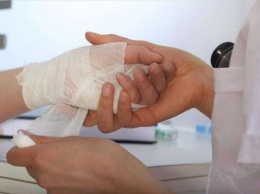 В Запорожской области постоялица гостиницы исполосовала себе руку