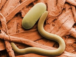 Врачи-паразитологи бьют тревогу! 95 % населения заражены паразитами