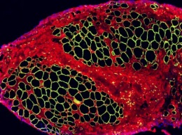 Ученые вырастили мышечную ткань при помощи стволовых клеток