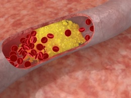 Повышение уровня «хорошего» холестерина не предотвращает болезни сердца