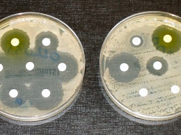 Антибиотики широкого спектра действия оказались деликатны к рибосомам бактерий