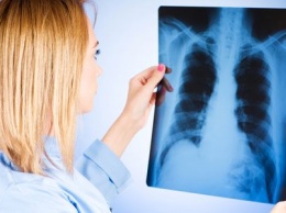 В Сумах зафиксировано шесть случаев туберкулеза среди детей