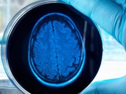 Британские ученые выращивают искусственные мозги в лаборатории