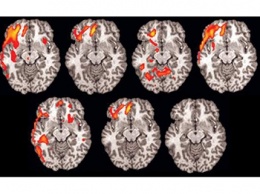 Томограмма мозга лучше полиграфа: ученые