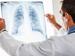Ученые смогут предсказывать возникновение рака легких у некурящих