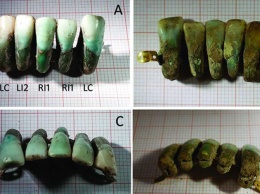 В Италии найден фрагмент древней вставной челюсти