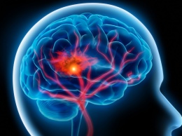 Ученые разработали методику лечения отека мозга