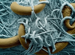 Бактерия-хищник уничтожает смертельные вирусы