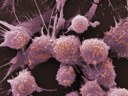 Ученые составили список продуктов, способствующих распространению раковых метастаз
