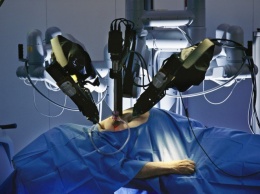 Ученые: По вине роботов-хирургов в США за 13 лет погибли 144 человека