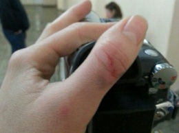 На концерте Виталия Козловского напали на журналиста (фото)